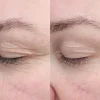 Bioeffect EGF Eye Serum silmänympärysseerumi 6ml