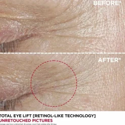 Clarins Total eye lift silmänympärysvoide 15ml