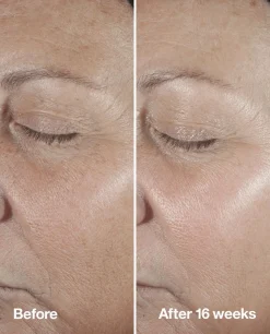 Clinique Smart Clinical Repair Seerumi 30 ml