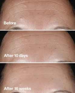 Clinique Smart Clinical Repair Seerumi 30 ml