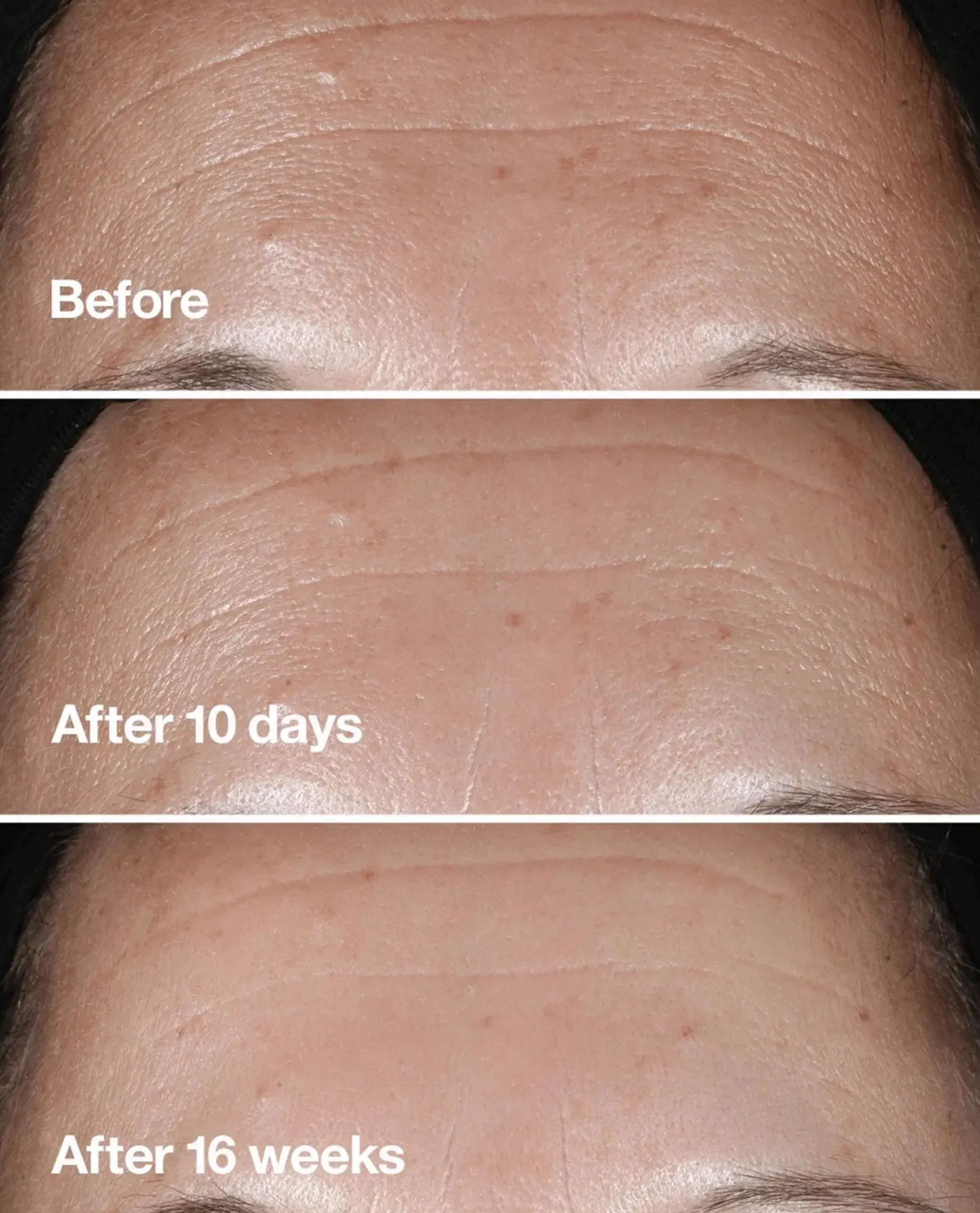 Clinique Smart Clinical Repair Seerumi 30 ml