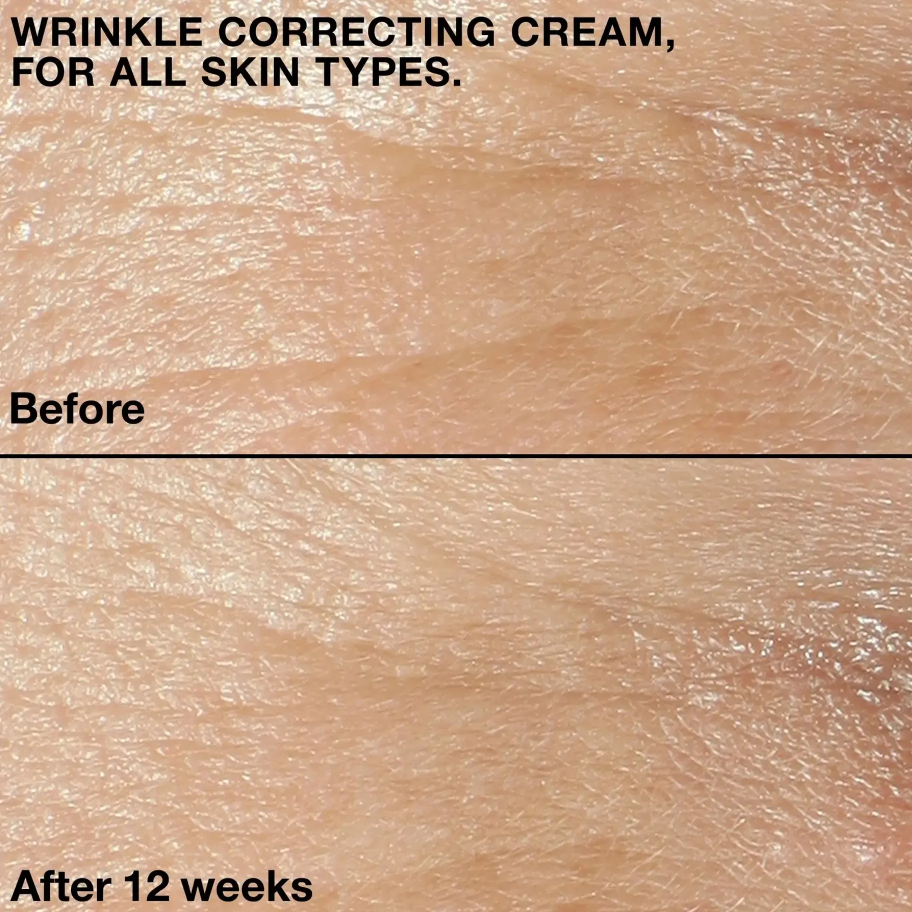 Clinique Smart Clinical Repair Wrinkle Correcting Cream kosteusvoide 50 ml