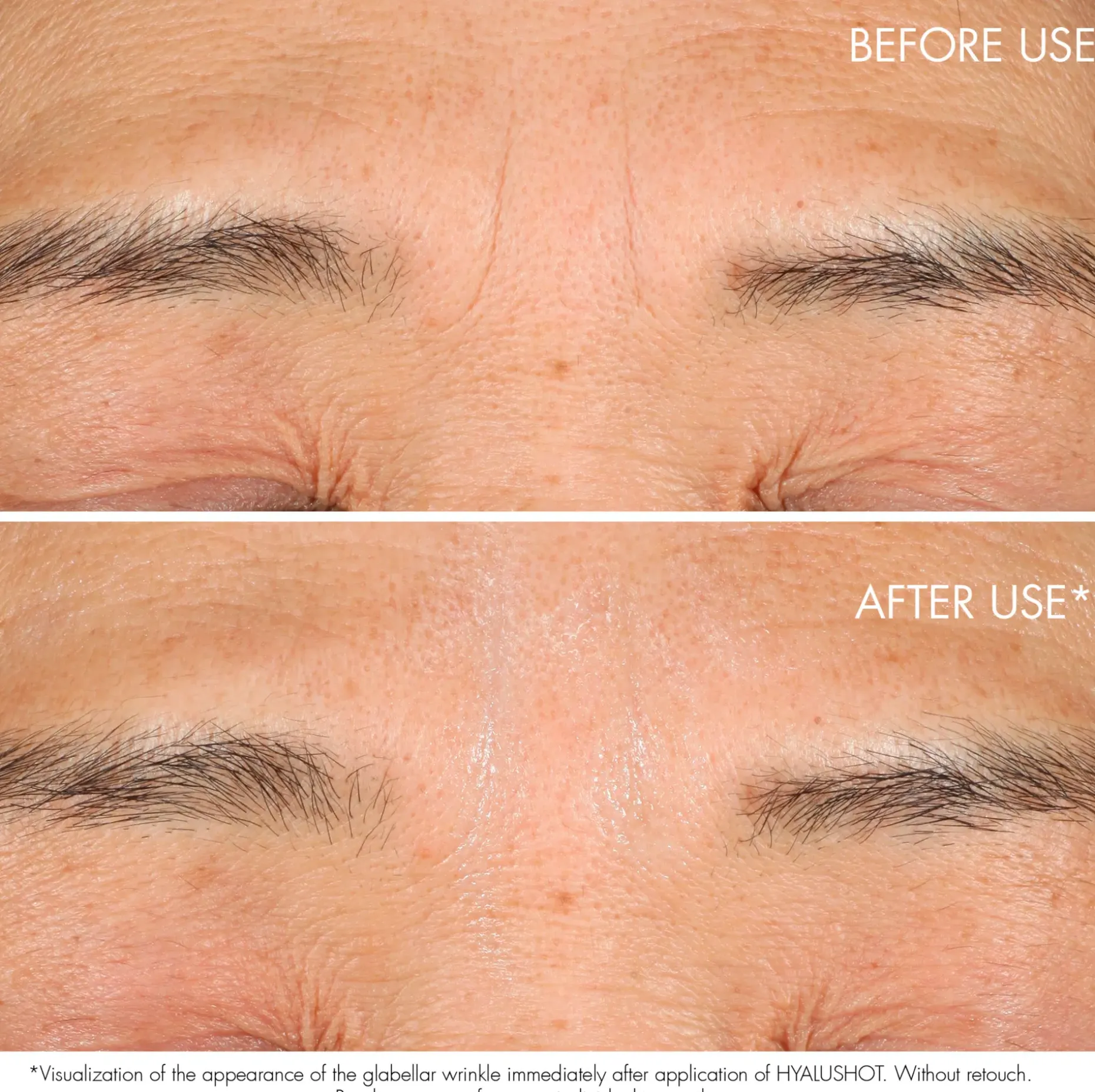 DIOR Capture Totale Retishot Retinol Skin Quality Renewer yötiiviste 20 ml