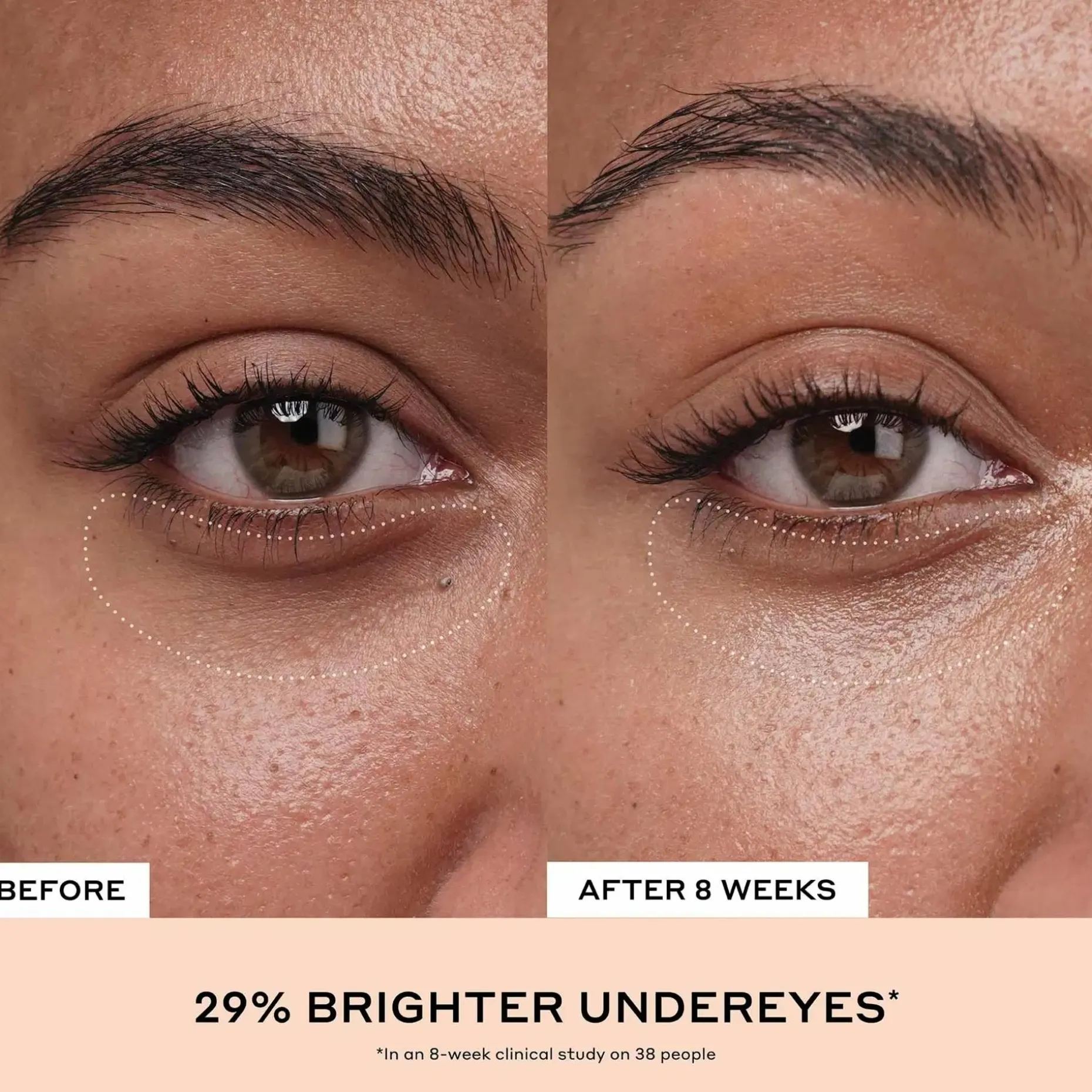 OleHenriksen Truth Banana Bright + Eye Cream silmänympärysvoide 15 ml